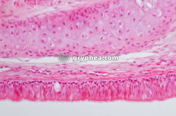 Trachée x100 - gryphea.org